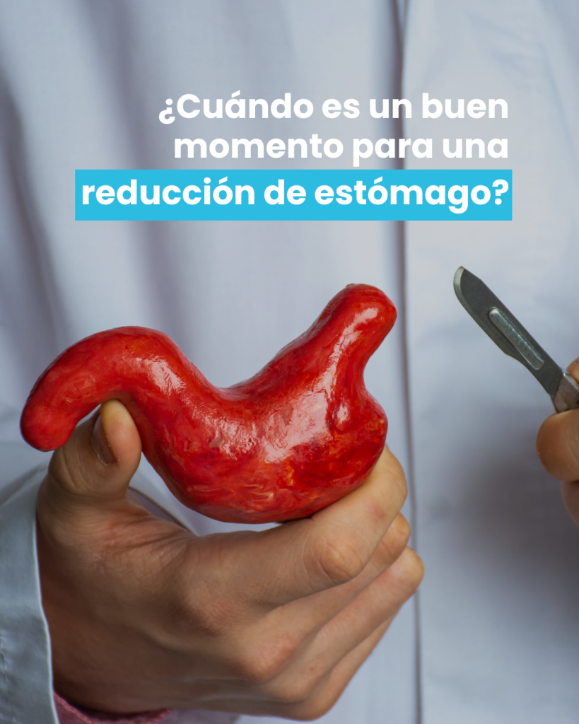 reducción estómago