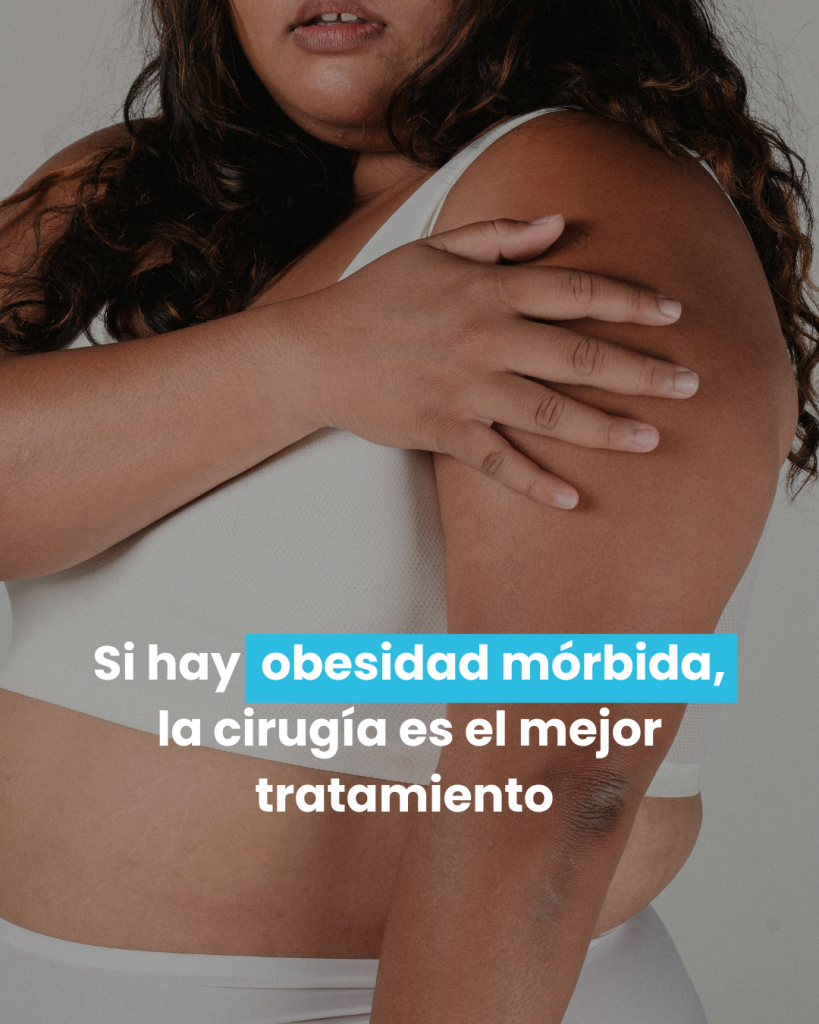 obesidad mórbida y cirugía